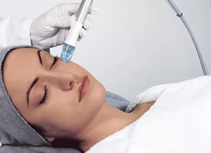 Microdermabrasion Crorindon